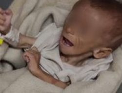 Bayi Palestina 2,5 Bulan Alami Kekurangan Gizi Parah, Butuh Evakuasi Medis