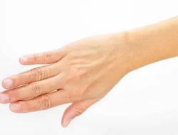 Cara Jaga Kesehatan Kulit Saat Cuaca Panas dengan 5 Tips Ini!